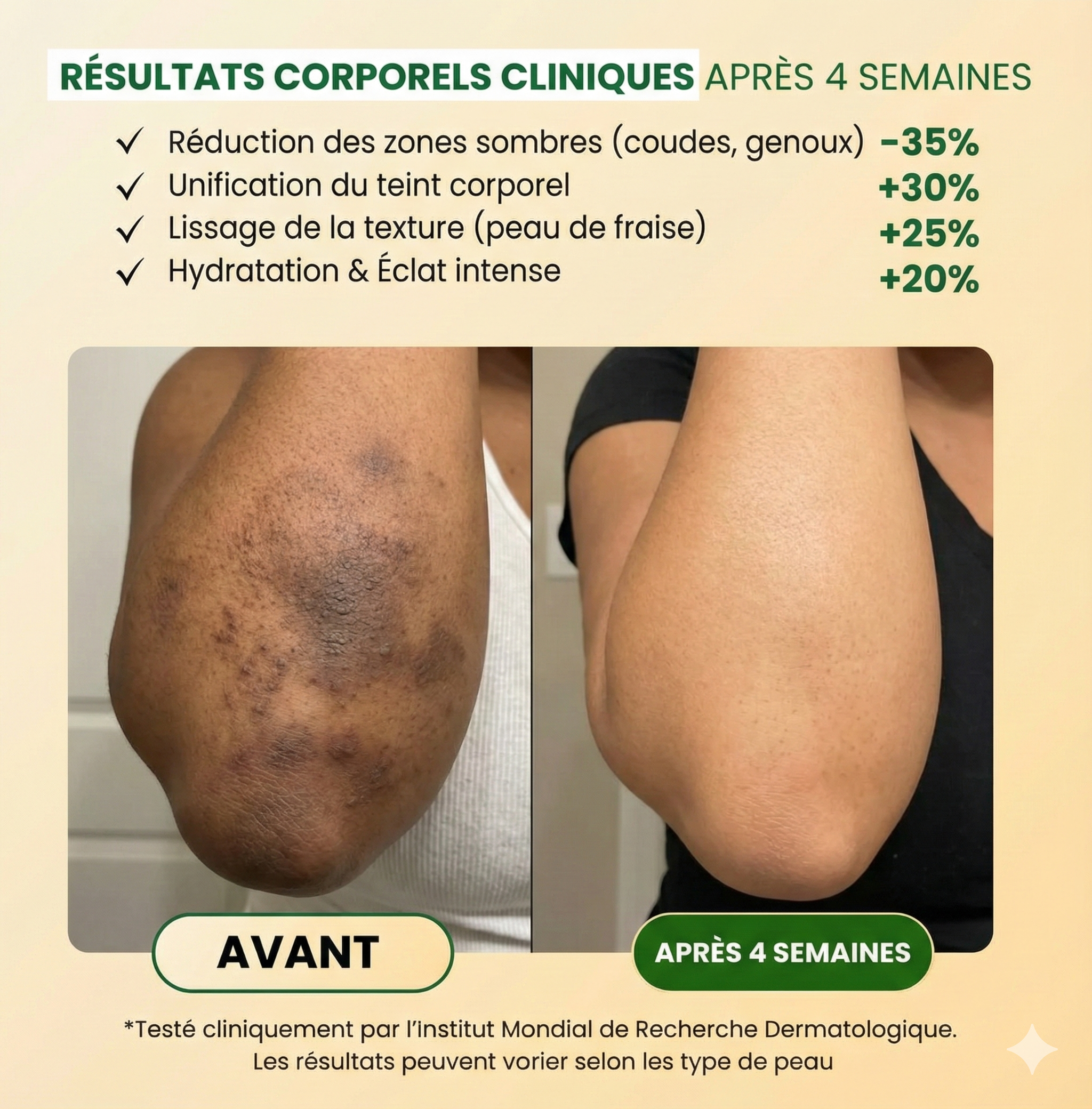 Savon Corps Anti-Taches & Glow (Curcuma + Kojic)